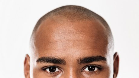 afro saç ekimi afro saç ekimi