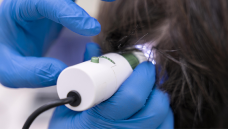 saç ekim tedavisi nasıl yapılır