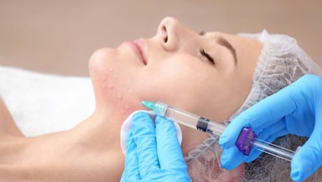 Dermal Dolgu Nasıl Uygulanır