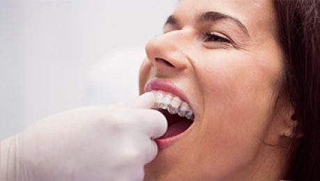 Zirkonya Alt Yapı Dişleri