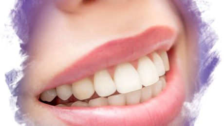 pembe-diş-estetiği