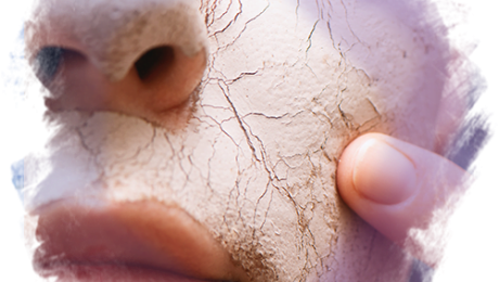 Cilt-Çatlakları-Nedir