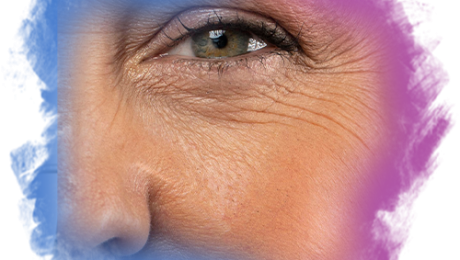 Yüz-Kırışıklıkları-İçin-En-İyi-Tedavi-Yöntemleri-Nelerdir Yuz Kirisikliklari