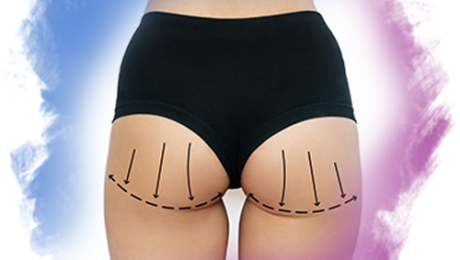 Popo Estetiği Popo Estetiği Sonrası Dikkat edilmesi Gerekenler