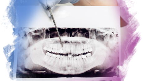 Diş Numarası Nedir diş numaralandırma