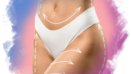 Karın germe (tummy tuck) ve liposuction