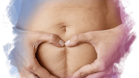 Doğum Sonrası Karın ve Kalça Çatlağı Tedavisi