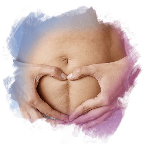 Doğum Sonrası Karın ve Kalça Çatlağı Tedavisi