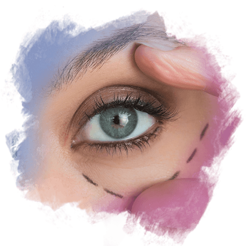 Fox Eyes (Badem Göz) Estetiği Fox Eyes (Badem Göz) Estetiği