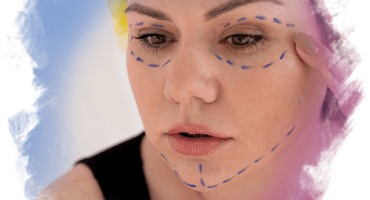 Kombine Yüz Gençleştirme Yöntemleri