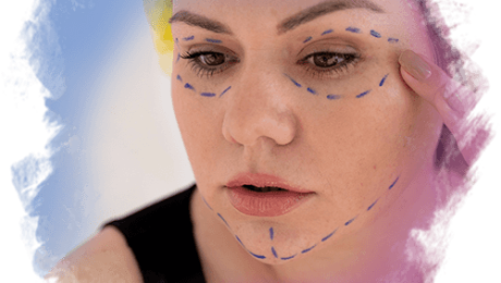 Kombine Yüz Gençleştirme Yöntemleri